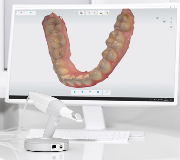 Coconut Grove 3D Cone Beam and 3D Dental Scans