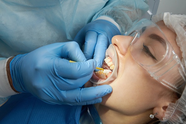 How Often Should You Get A Deep Teeth Cleaning?