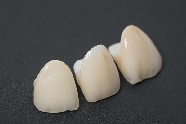 When Is Getting A Dental Crown Necessary?