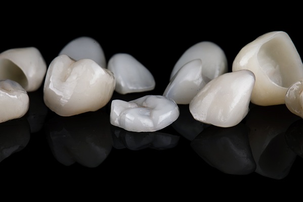 Understanding Dental Crowns Versus Veneers