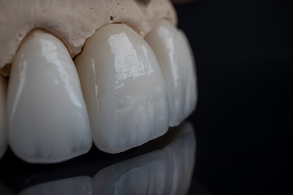 What Is The Purpose Of Dental Crowns?