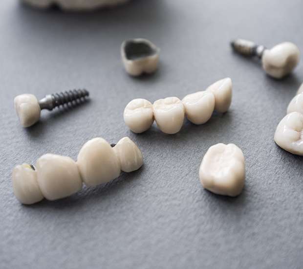 Coconut Grove The Difference Between Dental Implants and Mini Dental Implants
