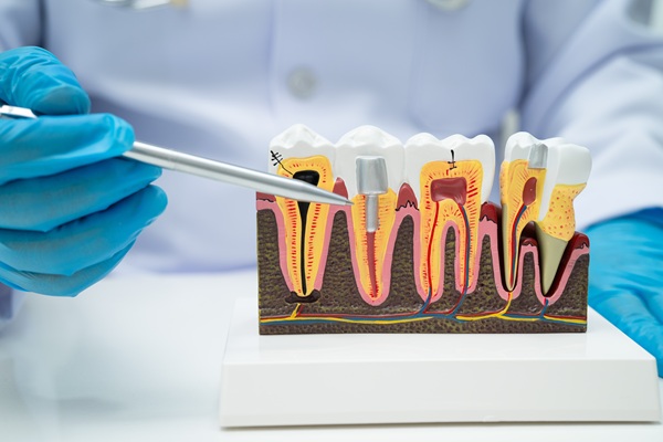 Common Myths About Root Canals, Debunked By Dentists